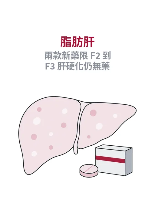 脂肪肝新藥適用於未肝硬化且纖維化 F2 至 F3 的治療分期圖