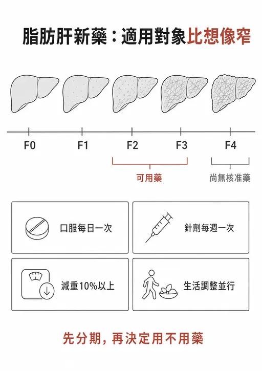 脂肪肝新藥只適用於未肝硬化、纖維化 F2 到 F3 的患者，F4 肝硬化尚無核准的肝臟標靶藥物