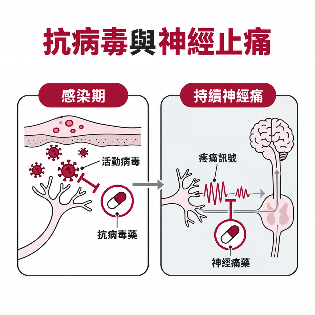 抗病毒藥處理帶狀疱疹感染期而神經痛藥處理持續疼痛訊號的對照圖