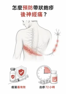 預防帶狀皰疹後神經痛：完成疫苗接種，出疹後七十二小時內盡快就醫評估