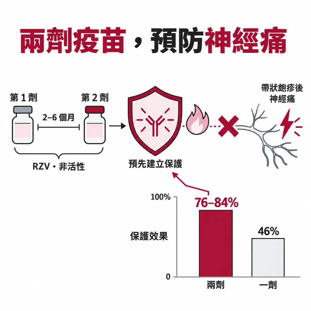 發病前接種帶狀皰疹疫苗建立保護,可降低帶狀皰疹後神經痛風險