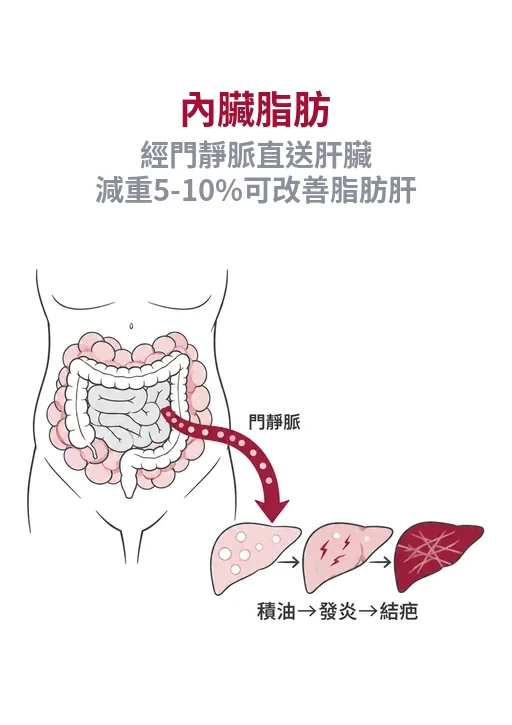 內臟脂肪釋出的脂肪酸經門靜脈到肝臟，可能造成積油與結疤