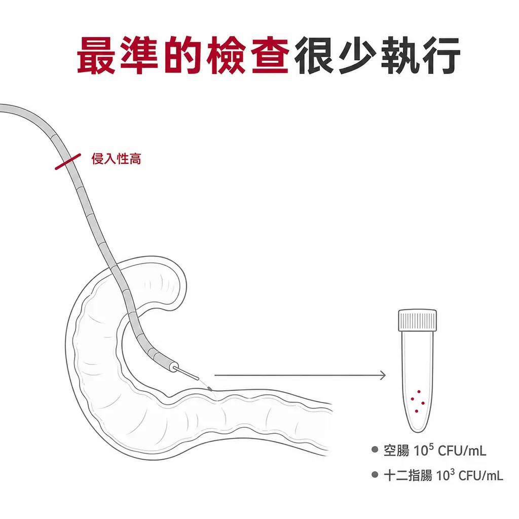 示意圖：內視鏡經胃進入十二指腸抽取腸液做細菌培養，判定標準為空腸 10⁵ CFU/mL 或十二指腸 10³ CFU/mL，但侵入性高