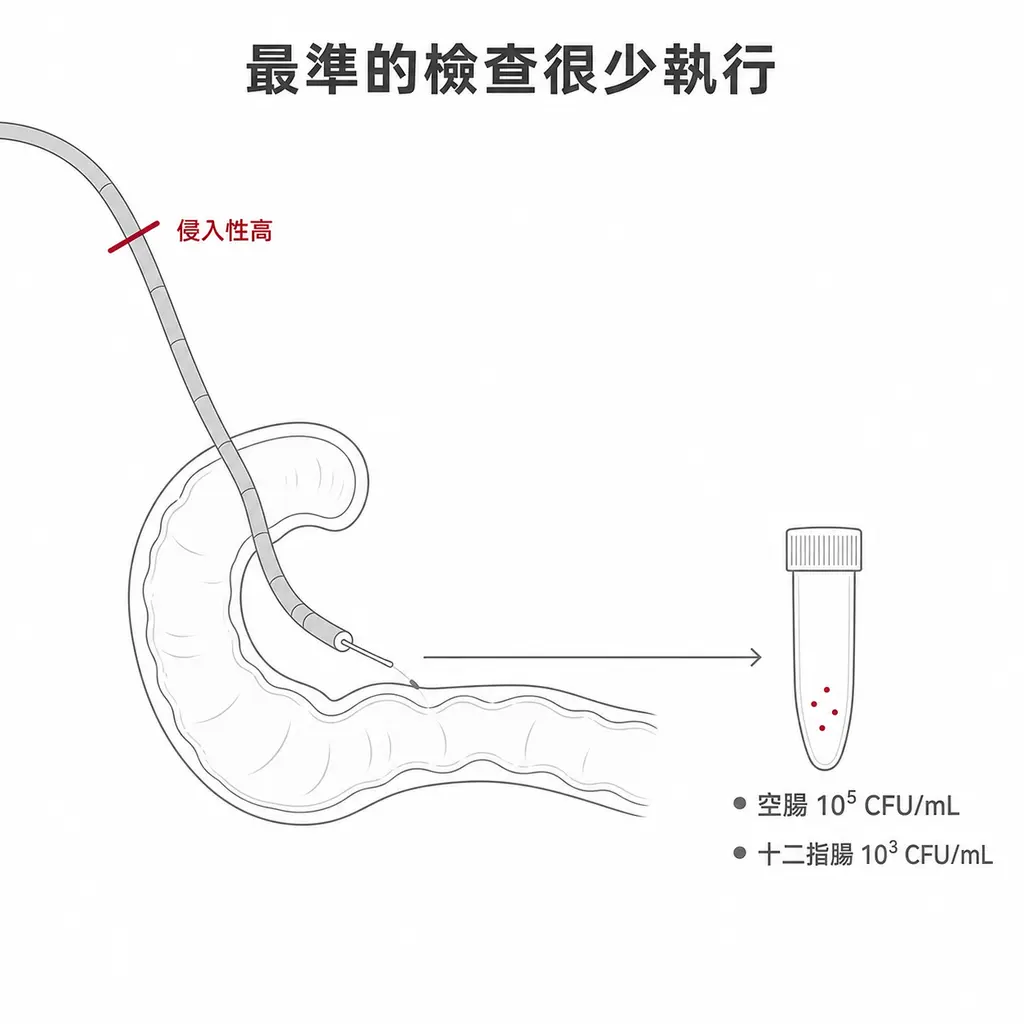 示意圖:內視鏡經胃進入十二指腸抽取腸液做細菌培養,判定標準為空腸 10⁵ CFU/mL 或十二指腸 10³ CFU/mL,但侵入性高
