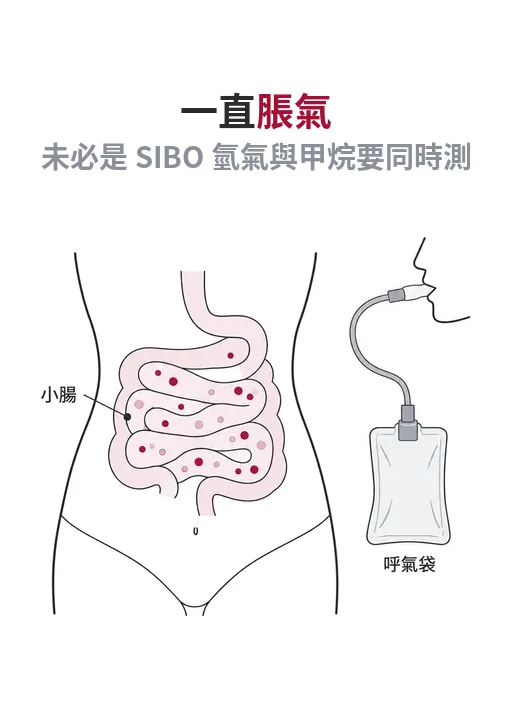 一直脹氣就是 SIBO 嗎：呼氣檢查重點圖