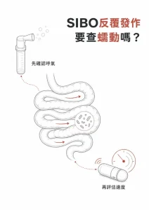 SIBO 反覆發作與腸道蠕動檢查重點圖