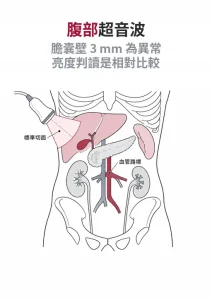 手持超音波探頭抵在上腹部，下方為肝臟、膽囊、胰臟、脾臟與腎臟的線稿