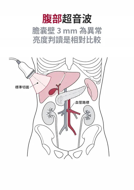 手持超音波探頭抵在上腹部，下方為肝臟、膽囊、胰臟、脾臟與腎臟的線稿