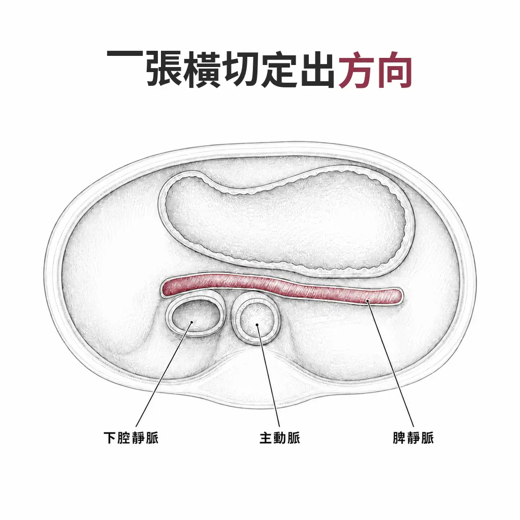 上腹橫切面同時顯示主動脈、下腔靜脈、脾靜脈與胃,形成判讀時的座標
