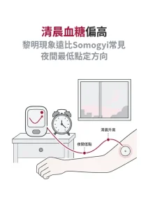 清晨血糖為什麼偏高？黎明現象遠比 Somogyi 效應常見，分辨要看夜間最低點
