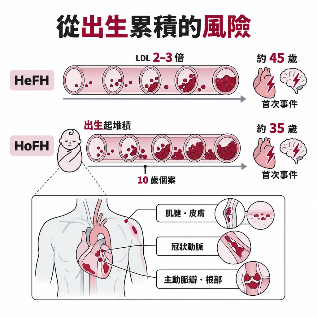 未治療時 HeFH 第一次心血管事件約 45 歲，HoFH 約 35 歲、兒童期也可能出現；HoFH 從出生起膽固醇就堆積在肌腱、皮膚、冠狀動脈與主動脈瓣