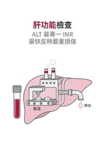 肝功能檢查分三層：GPT 與 GOT 看細胞受傷，白蛋白與凝血看肝還能不能工作，FIB-4 到彈性掃描看纖維化
