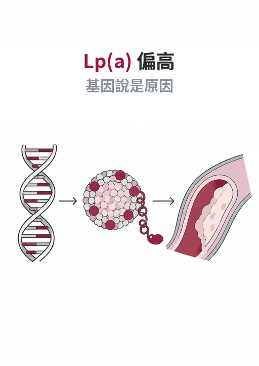 Lp(a) 是心血管疾病的原因嗎：LPA 基因決定的 Lp(a) 顆粒卡在動脈斑塊裡
