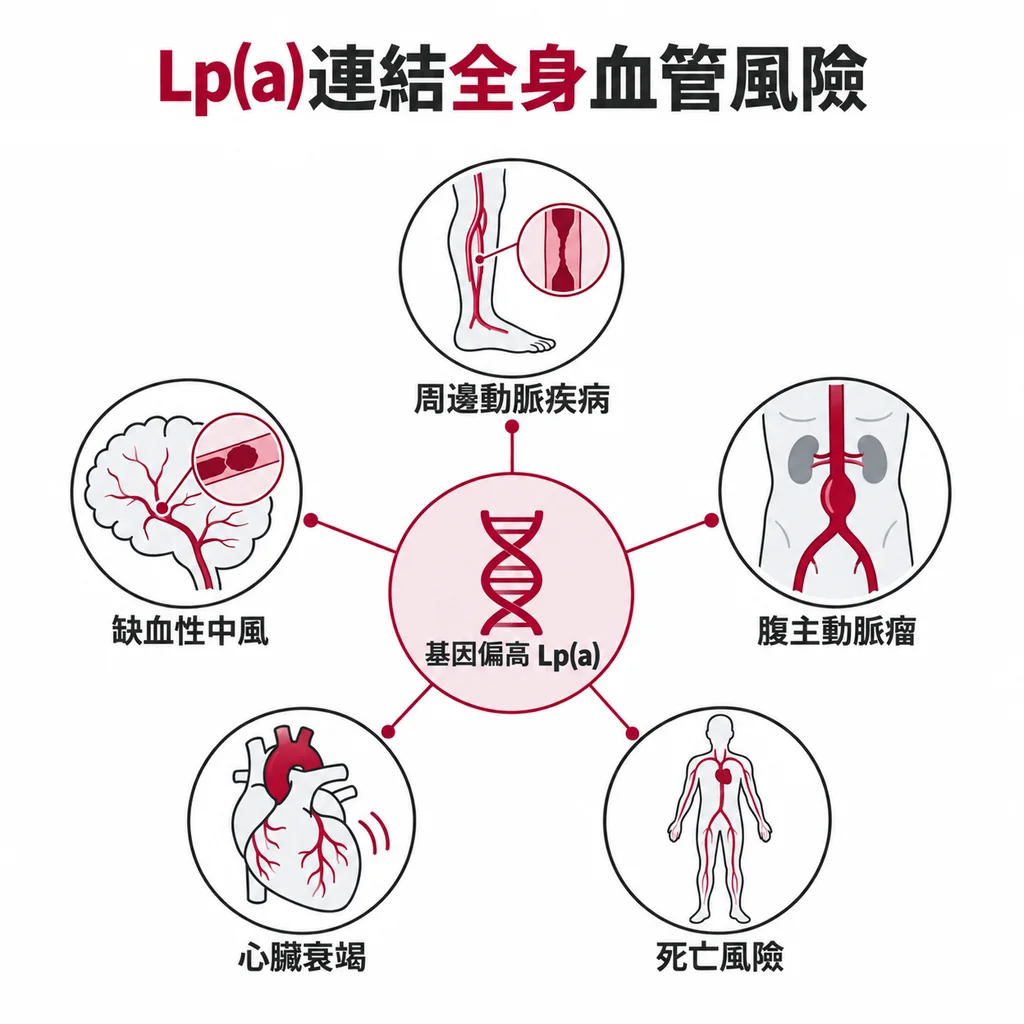 基因上偏高的 Lp(a) 同時連到腿部動脈、腹主動脈、腦血管與心臟的疾病