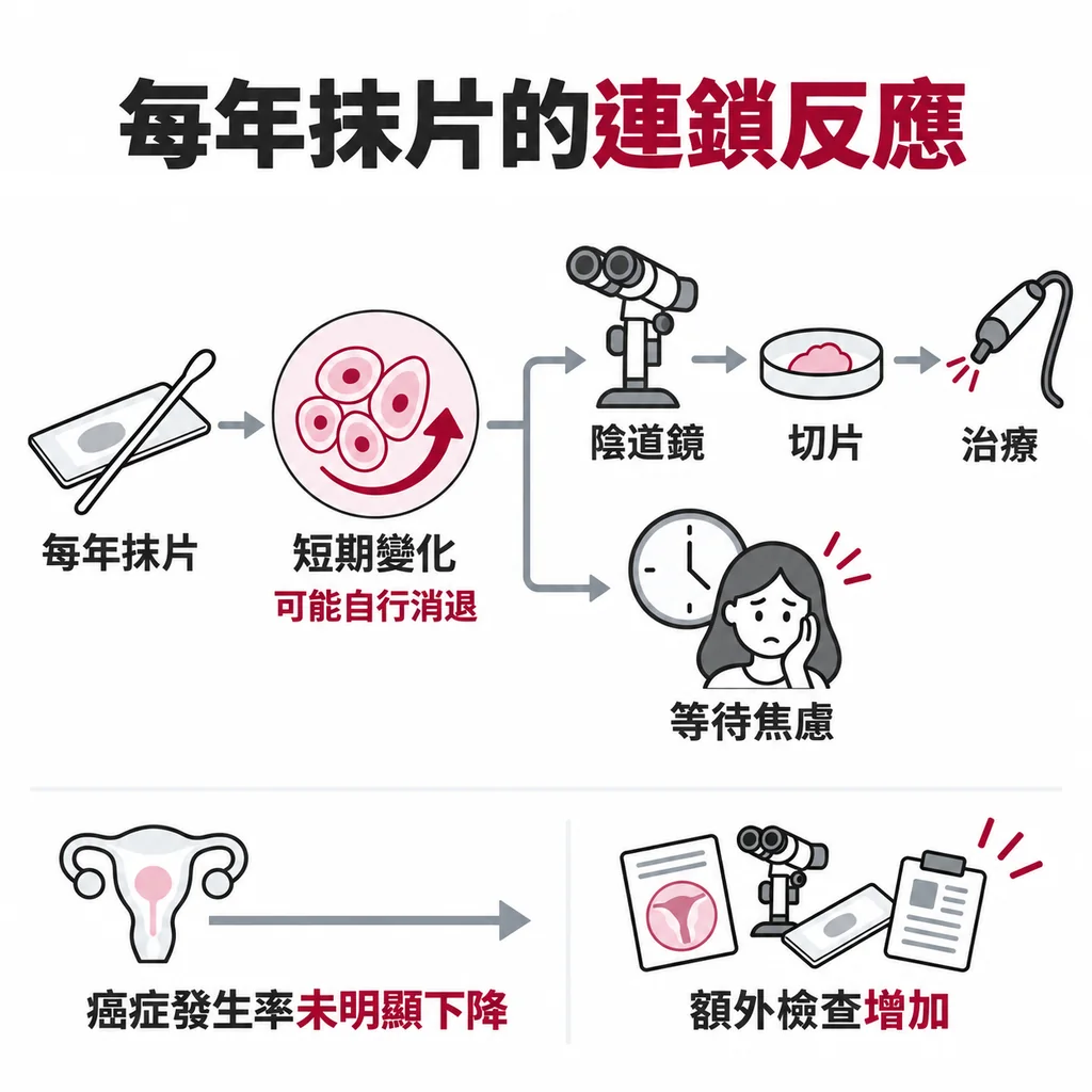 每年抹片的連鎖反應：抓到會自行消退的變化→陰道鏡→切片→治療，子宮頸癌發生率卻沒有明顯下降
