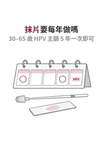 子宮頸抹片需要每年做嗎？一般風險每 3 年，30 歲後 HPV 檢測每 5 年