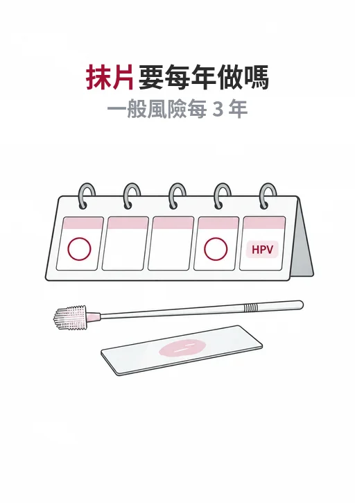 子宮頸抹片需要每年做嗎？一般風險每 3 年，30 歲後 HPV 檢測每 5 年