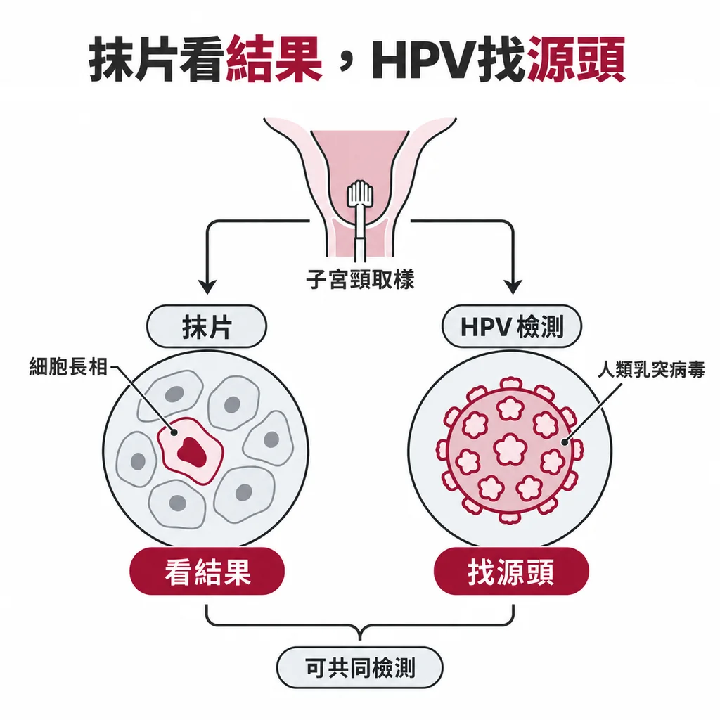 抹片看子宮頸細胞的長相，HPV 檢測找人類乳突病毒；一個看結果、一個看源頭