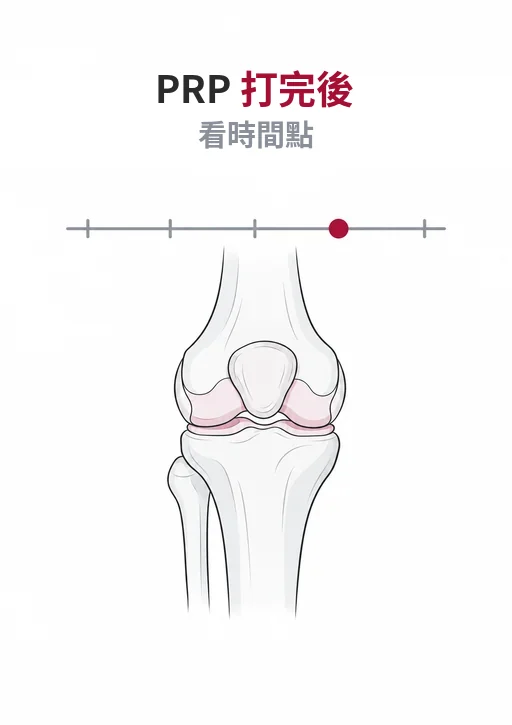 上方針筒與日曆線稿，下方膝關節與時間軸，三個月處標記為判斷有無反應的分水嶺