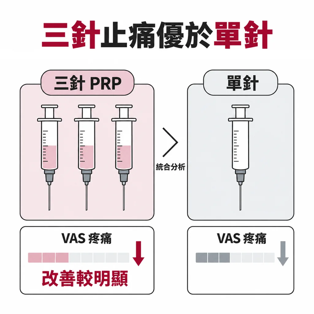 三支裝有 PRP 的針筒與一支空針筒並排比較，統合分析顯示三針的疼痛改善明顯優於單針