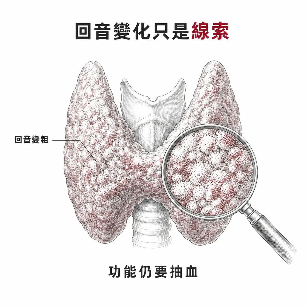低回音與粗糙紋理是自體免疫甲狀腺炎的支持性線索,功能仍要靠抽血判斷
