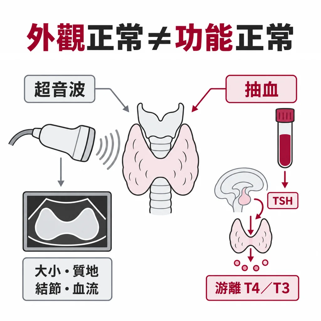 同一個甲狀腺外觀正常也可能功能異常，超音波看不出甲亢或甲低