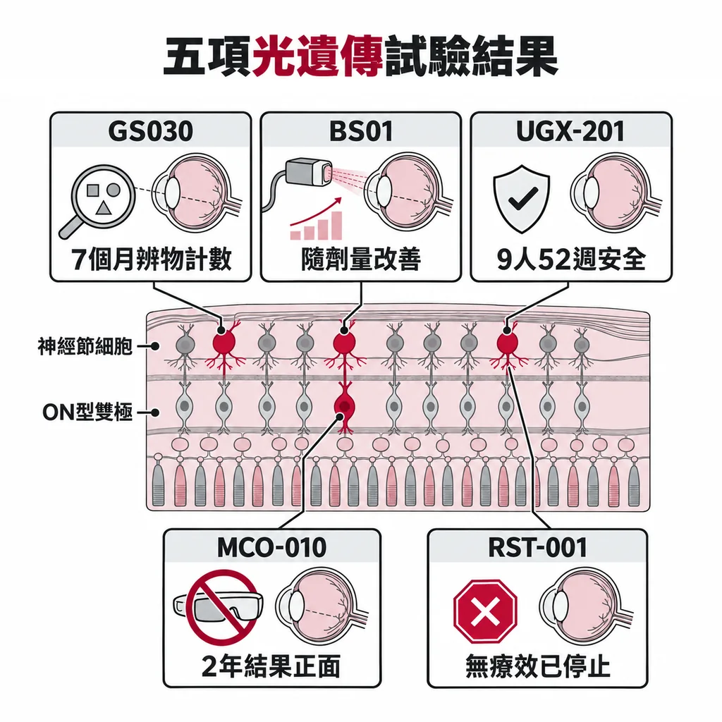 五個光遺傳試驗比較:GS030、BS01、MCO-010、UGX-201 有初步結果,RST-001 沒有看到療效,已停止發展