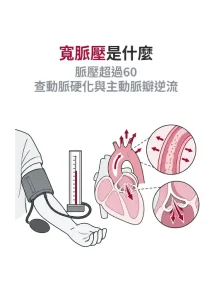 寬脈壓是什麼？收縮壓與舒張壓差超過 60，背後可能是動脈變硬或主動脈瓣逆流